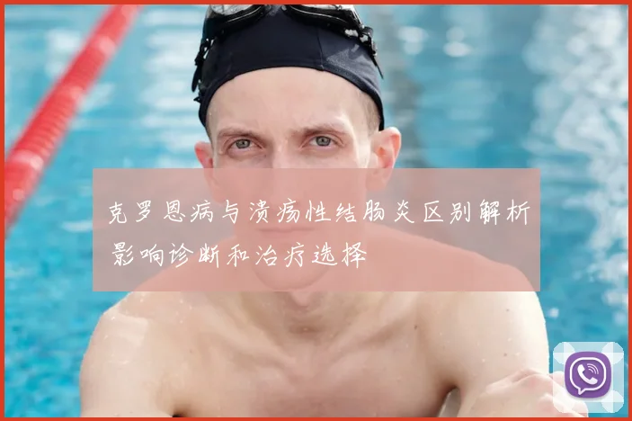 克罗恩病与溃疡性结肠炎区别解析 影响诊断和治疗选择